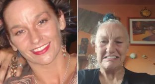 A woman spent all her money on new teeth and "aged 20 years" in one day (4 photos)