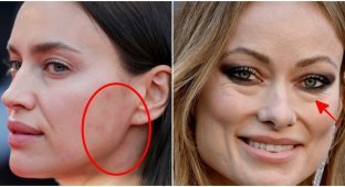 What celebrity skin really looks like (16 photos)