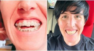 Люди, які змінили життя, коли зайнялися зубами (13 фото)