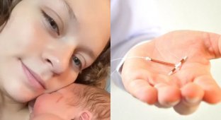 Кіндер-сюрприз: мешканка США народила дитину, яка стискала в руці протизаплідну спіраль (6 фото)
