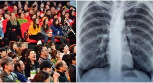 Chinese Man Torn Lung When He Loudly Shouted At Concert Of Favorite Band (2 Photos)