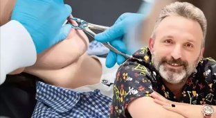 Турецкий уборщик выдал себя за стоматолога и удалил мужчине несколько зубов (4 фото)