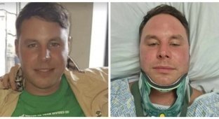 A man broke his neck while taking a contrast shower (3 photos)