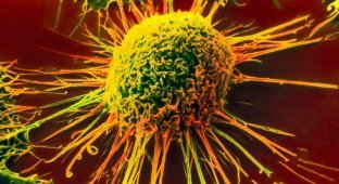 Новая технология распознает рак за 10 секунд (3 фото)