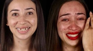 Дантист из Бразилии возвращает красивые улыбки людям, которые не могут оплатить операции (10 фото)