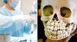 25 Strange, Disgusting, and Creepy Facts About the Human Body (26 photos)