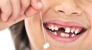 10 самых странных фактов о зубах (10 фото)