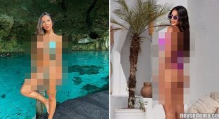 29-year-old model died after liposuction of fat from knees (3 photos)