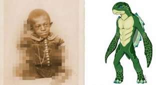 Джордж Уильямс – мальчик-черепаха и его история (5 фото)