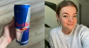 Woman who drank energy drinks every day for 15 years talks about the consequences (3 photos + 1 video)