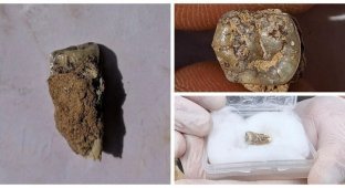 В Грузии раскопали зуб древнего человека, жившего 1,8 млн лет назад (5 фото)