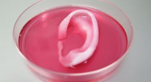Учёные распечатали на 3D-принтере человеческое ухо для трансплантации (7 фото)