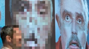 Обезображенный 64-летний канадец получил новое лицо (3 фото)