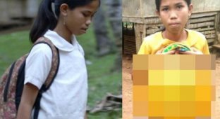 Филиппинской школьнице удалят лишние руки, растущие из живота (7 фото)