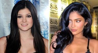 Kylie Jenner denies having plastic surgery on her face (3 photos)