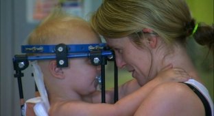 Австралийские врачи спасли жизнь ребенку, которому практически полностью оторвало голову в ДТП (2 фото)