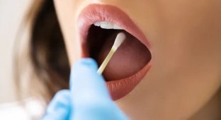 Вчені виявили можливу причину розвитку раку підшлункової залози.