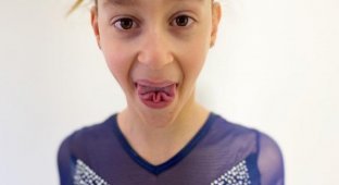 Люди с необычными особенностями тела (12 фото)