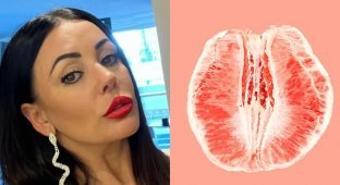 47-year-old Australian woman decided to have “designer vagina” surgery - and regretted it (4 photos)