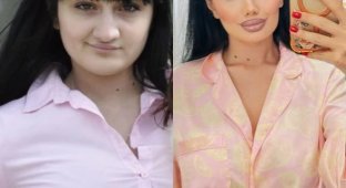 «Два разных человека»: апгрейд этой девушки стал вирусным — в сети спорят, сделала ли пластика её красивее (3 фото)
