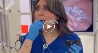 Врач делает себе гастроскопию