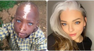 People with Waardenburg Syndrome, who were generously endowed by genetics (16 photos)