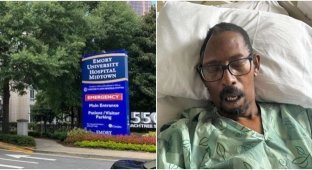 A patient in Atlanta sues doctors who lost a piece of his skull (3 photos + 1 video)