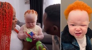 У чернокожих родителей получился ребёнок-альбинос с рыжими волосами (6 фото + 1 видео)