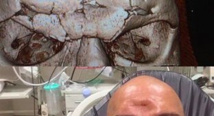 Боец ММА Майкл Пэйдж отправил соперника в нокаут, проломив ему череп (2 фото)