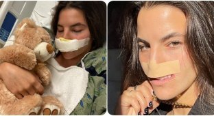 Зустріч з пітбулем назавжди змінила життя дівчини, позбавивши її верхньої губи (8 фото)