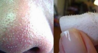 Как убрать черные точки на носу в домашних условиях (4 фото)