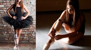 Даже с ампутированной ногой она выполнила свою мечту и стала балериной! (15 фото)