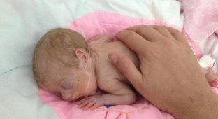 Touching story of a little baby (12 photos)
