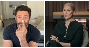 6 звёзд, которых не сломила тяжёлая болезнь (13 фото)