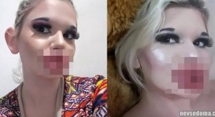 There is no limit to perfection: a big-lipped freak girl decided to enlarge her cheekbones (6 photos)