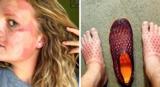 It hurts to look at: 16 people who overdid it with a tan (17 photos)