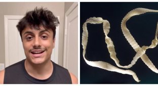 A man ate tapeworms for views (4 photos + 1 video)