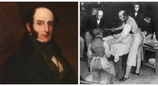 Robert Liston: I wanted the best, but got an absolute record for mortality (6 photos)