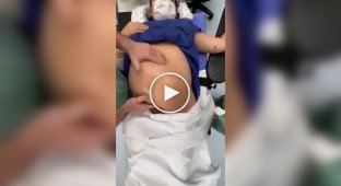 Лікар перевертає дитину в животі матері, щоб уникнути кесаревого розтину