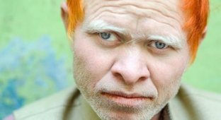 White crows: amazing albino people of different nationalities (19 photos)