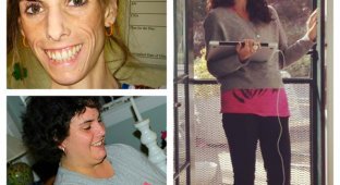 Бриттани Бегандер, испытавшая на себе, что значит страдать и от анорексии и от ожирения (9 фото)