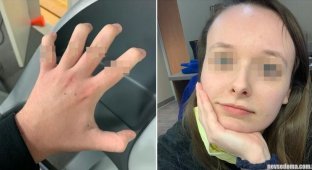 Features of the human body that are impressive (14 photos)