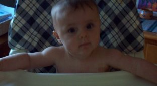 Ребенок с родимым пятном (3 фото)