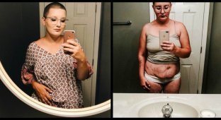 Женщина показала, как выглядит ее тело после 6 выкидышей и 4 родов (8 фото)