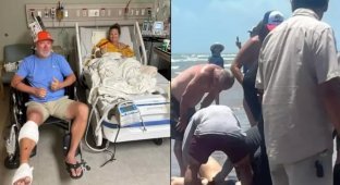 A victim of a shark attack spoke about the horror he experienced (5 photos)