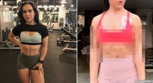 Fitness blogger decided to take injections to burn fat - and almost died (11 photos)