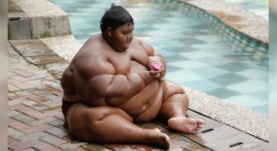 Самый толстый ребенок в мире похудел более чем на 100 килограмм (11 фото)