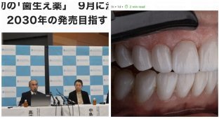 Первое в мире «лекарство для роста зубов» будет испытано в Японии с сентября 2024 года (3 фото)