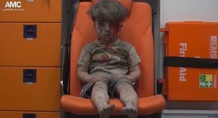 Эти снимки раненого пятилетнего сирийца потрясли мир! (17 фото)