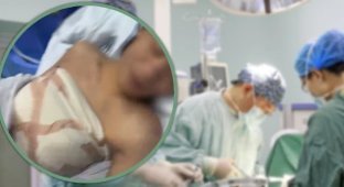 19-year-old guy was tricked into having breast augmentation surgery (3 photos)